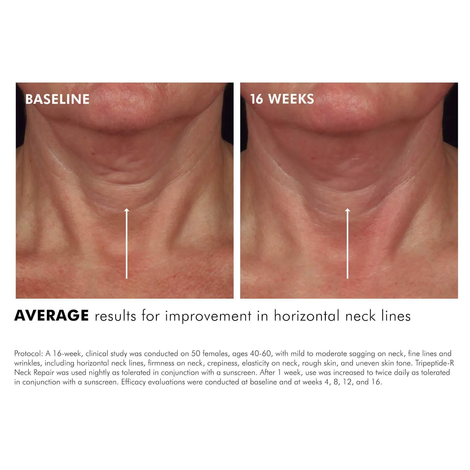 SkinCeuticals | Tripeptide-R Neck Repair 50ml